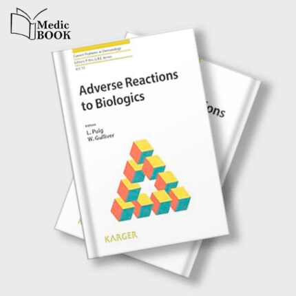 Adverse Reactions to Biologics (Current Problems in Dermatology) (EPUB)